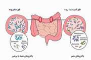 بررسی تغییرات میکروبیوتای روده بر BPH و اندیکاسیون های مختلف آن