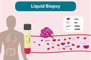تشخیص سرطان با استفاده هز liquid biopsy سه سال زودتر از سایر روش ها