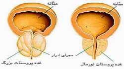 یک رویکرد جدید و برنامه ریزی مجدد ایمنی ضد تومور