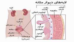 ارزیابی درمان ترکیبی سلول‌های NK و رئوویروس علیه سلول‌های سرطان مثانه با استفاده از یک سنجش آزمایشگاهی برای شبیه‌سازی درمان اینتراوزیکال مثانه‌