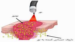 فتودینامیک تراپی فعال‌شده با پرتو (radioPDT) باعث پراکسیداسیون لیپیدی و پسرفت تومور در سرطان پروستات می‌شود