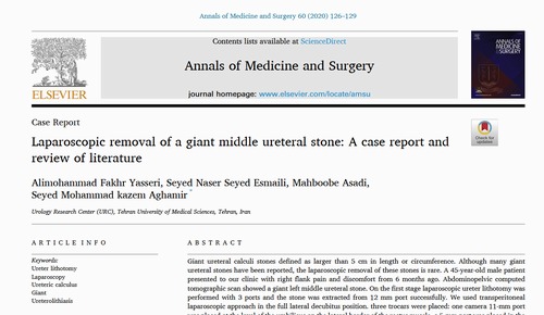 Laparoscopic removal of a giant middle ureteral stone: A case report and review of literature